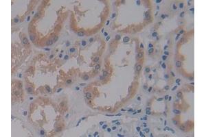 DAB staining on IHC-P; Samples: Human Kidney Tissue (CRY1 Antikörper  (AA 3-132))