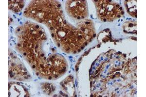 Image no. 11 for anti-F-Box Protein 21 (FBXO21) antibody (ABIN1498235)