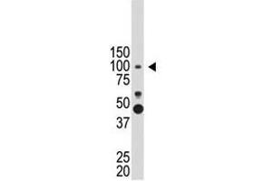 Image no. 1 for anti-Prospero Homeobox 1 (PROX1) (N-Term) antibody (ABIN357416) (PROX1 Antikörper  (N-Term))