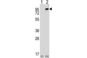 Western blot analysis of WHSC1L1 (arrow) using rabbit polyclonal WHSC1L1 Antibody (N-term) .