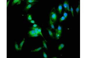Immunofluorescence staining of Hela cells with ABIN7142091 at 1:133, counter-stained with DAPI.