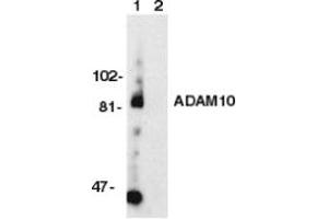 Image no. 1 for anti-ADAM Metallopeptidase Domain 10 (ADAM10) (AA 732-748) antibody (ABIN201912) (ADAM10 Antikörper  (AA 732-748))