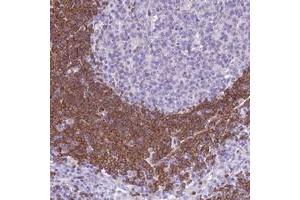 Immunohistochemical staining of human lymph node with BANK1 polyclonal antibody  shows strong cytoplasmic positivity in lymphoid cells outside reaction centra. (BANK1 Antikörper)