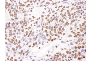 Immunohistochemistry (IHC) image for anti-Poly A Binding Protein Nuclear 1 (PABPN1) (AA 1-50) antibody (ABIN7454922) (PABPN1 Antikörper  (AA 1-50))