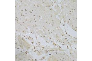 Immunohistochemistry (Paraffin-embedded Sections) (IHC (p)) image for anti-TSC22 Domain Family, Member 3 (TSC22D3) (AA 1-79) antibody (ABIN6149613)
