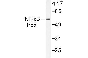 Image no. 1 for anti-Nuclear Factor-kB p65 (NFkBP65) antibody (ABIN271746) (NF-kB p65 Antikörper)