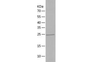 Yae1 Domain Containing 1 (YAE1D1) (AA 1-226) protein (His tag)