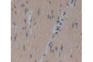 IHC-P analysis of Human Tissue, with DAB staining. (CCDC80 Antikörper  (AA 635-906))
