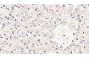 Detection of SIRT3 in Human Liver Tissue using Monoclonal Antibody to Sirtuin 3 (SIRT3) (SIRT3 Antikörper  (AA 126-399))