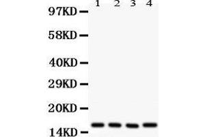 Western Blotting (WB) image for anti-Caveolin 2 (CAV2) (AA 1-162) antibody (ABIN3043749) (Caveolin 2 Antikörper  (AA 1-162))