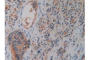 Immunohistochemistry (IHC) image for anti-Dipeptidyl-Peptidase 4 (DPP4) (AA 484-728) antibody (ABIN7432829)