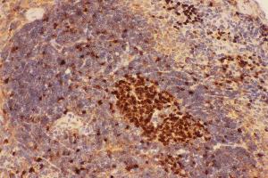 Immunohistochemistry (IHC) image for anti-Beclin 1, Autophagy Related (BECN1) (AA 1-354) antibody (ABIN3042322)