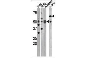 Image no. 1 for anti-Cell Division Cycle 25 Homolog A (S. Pombe) (CDC25A) (pSer76) antibody (ABIN358097) (CDC25A Antikörper  (pSer76))