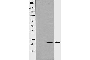 Western blot analysis of Hela whole cell lysates, using CBX5 Antibody. (CBX5 Antikörper  (Internal Region))