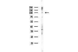 Western blot analysis of lysates from COLO205 cells(heat-shock,45 min treatment), using Phospho-NF kappaB p100/p52 (Ser866) Antibody at 1/1000 dilution.