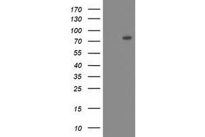 Western Blotting (WB) image for anti-Oxysterol Binding Protein-Like 11 (OSBPL11) antibody (ABIN1499920)