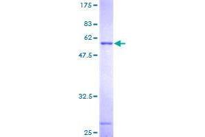 THG1L Protein (AA 1-269) (GST tag)