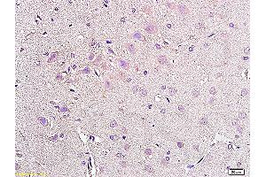 Formalin-fixed and paraffin embedded rat brain tissue labeled with Anti-NPY2R Polyclonal Antibody, Unconjugated (ABIN730063) at 1:200, followed by conjugation to the secondary antibody and DAB staining (NPY2R Antikörper  (AA 301-381))