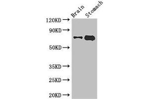 Western Blot Positive WB detected in: Mouse brain tissue, Mouse stomach tissue All lanes: EXD2 antibody at 2. (EXD2 Antikörper  (AA 137-245))