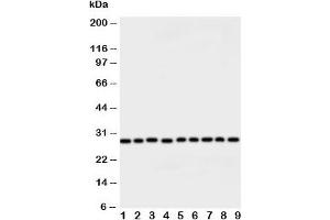Western blot testing of Peroxiredoxin 3 antibody and rat samples: 1. (Peroxiredoxin 3 Antikörper  (AA 239-256))