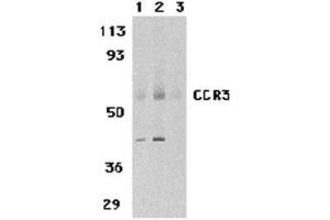 Western blot analysis of CCR3 in human spleen tissue lysates with AP30216PU-N CCR3 antibody at 1 (lane 1) and 2 μg/ml (lane 2), and 2 μg/ml in the presence of blocking peptide (lane 3). (CCR3 Antikörper  (N-Term))