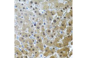 Immunohistochemistry of paraffin-embedded human liver injury using RNF166 antibody. (RNF166 Antikörper)