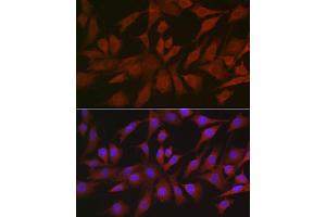 Immunofluorescence analysis of NIH/3T3 cells using EIF4ENIF1 Rabbit pAb (ABIN7267051) at dilution of 1:100 (40x lens). (EIF4ENIF1 Antikörper  (AA 150-250))