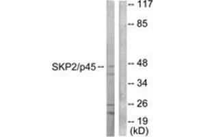 Western blot analysis of extracts from 293 cells, using SKP2/p45 Antibody.
