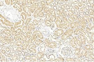 Immunohistochemical analysis of paraffin-embedded Human kidney section using Pink1 A. (BAP1 Antikörper  (AA 36-66))