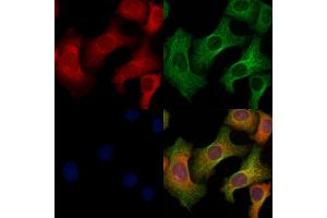 ABIN6264702 and ABIN6269113 staining Hela cells by IF/ICC. (Ret Proto-Oncogene Antikörper  (C-Term))