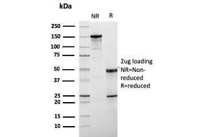 SDS-PAGE Analysis Purified HER-2 Mouse Monoclonal Antibody (ERBB2/3078). (ErbB2/Her2 Antikörper  (AA 311-462))
