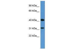 WB Suggested Anti-OR2W1 Antibody Titration: 0.