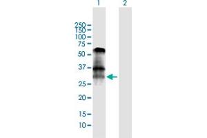 Western Blot analysis of BNIP3 expression in transfected 293T cell line by BNIP3 MaxPab polyclonal antibody. (BNIP3 Antikörper  (AA 1-194))