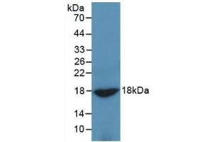 Detection of Recombinant ADP, Rat using Monoclonal Antibody to Adiponectin (ADPN) (ADIPOQ Antikörper  (AA 111-244))