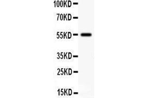 Anti- SSTR2 antibody, Western blotting All lanes: Anti SSTR2  at 0. (SSTR2 Antikörper  (Middle Region))