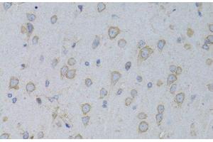 Immunohistochemistry of paraffin-embedded Rat brain using GARS Polyclonal Antibody at dilution of 1:100 (40x lens). (GARS Antikörper)