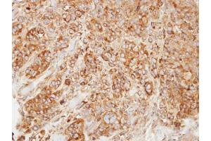 IHC-P Image Immunohistochemical analysis of paraffin-embedded SW480 xenograft, using HMGCL, antibody at 1:500 dilution. (HMGCL Antikörper  (full length))