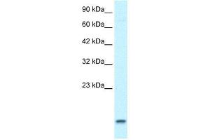 WB Suggested Anti-UBE2N  Antibody Titration: 1. (UBE2N Antikörper  (Middle Region))