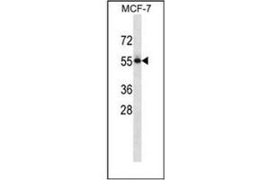 Western blot analysis of CD113 / Nectin 3 Antibody (C-term) in MCF-7 cell line lysates (35ug/lane). (nectin-3 Antikörper  (C-Term))