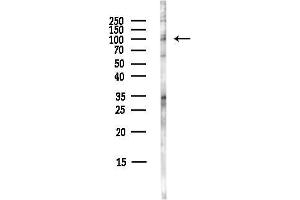 Western blot analysis of lysates from COLO205 cells(heat-shock,45 min treatment), using PACE4 Antibody at 1/1000 dilution.