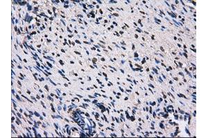 Immunohistochemical staining of paraffin-embedded liver tissue using anti-RPA2 mouse monoclonal antibody. (RPA2 Antikörper)