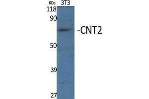 Western Blotting (WB) image for anti-Solute Carrier Family 28 (Sodium-Coupled Nucleoside Transporter), Member 2 (SLC28A2) (Internal Region) antibody (ABIN3183992)