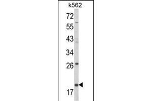 Western blot analysis of KLRD1 Antibody (N-term) (ABIN652571 and ABIN2842384) in K562 cell line lysates (35 μg/lane). (CD94 Antikörper  (N-Term))