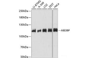 Western blot analysis of extracts of various cell lines using ABI3BP Polyclonal Antibody at dilution of 1:1000. (ABI3BP Antikörper)