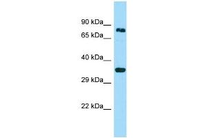 WB Suggested Anti-HOOK3 Antibody Titration: 1. (HOOK3 Antikörper  (C-Term))