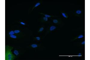 Immunofluorescence of purified MaxPab antibody to IFIT2 on HeLa cell. (IFIT2 Antikörper  (AA 1-484))