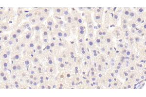 Detection of Raftlin in Mouse Liver Tissue using Polyclonal Antibody to Raft Linking Protein (Raftlin) (RFTN1 Antikörper  (AA 207-451))