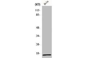Western Blot analysis of COLO205 cells using MRP-L20 Polyclonal Antibody