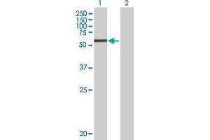 Western Blotting (WB) image for C1S 293T Cell Transient Overexpression Lysate(Denatured) (ABIN1331109)