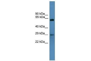 Western Blot showing TP53RK antibody used at a concentration of 1-2 ug/ml to detect its target protein. (TP53RK Antikörper  (N-Term))
